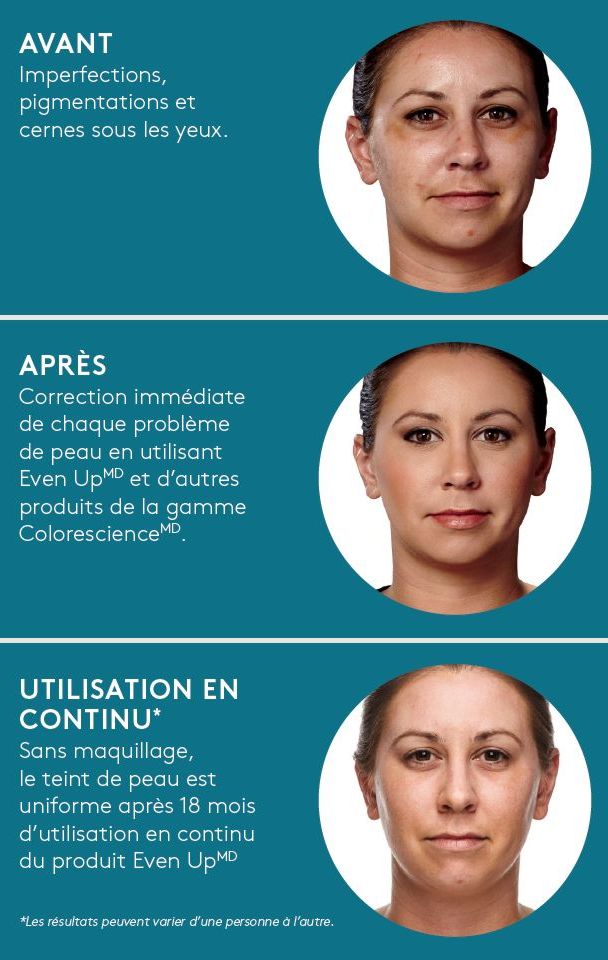 Even-UP Avant Après ColorScience | Produits de soins de la peau | OM Signature Esthétique Médical